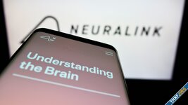 Neuralink ได้รับการอนุมัติจาก FDA สหรัฐฯ ให้ทดลองฝังชิปในมนุษย์ได้แล้ว